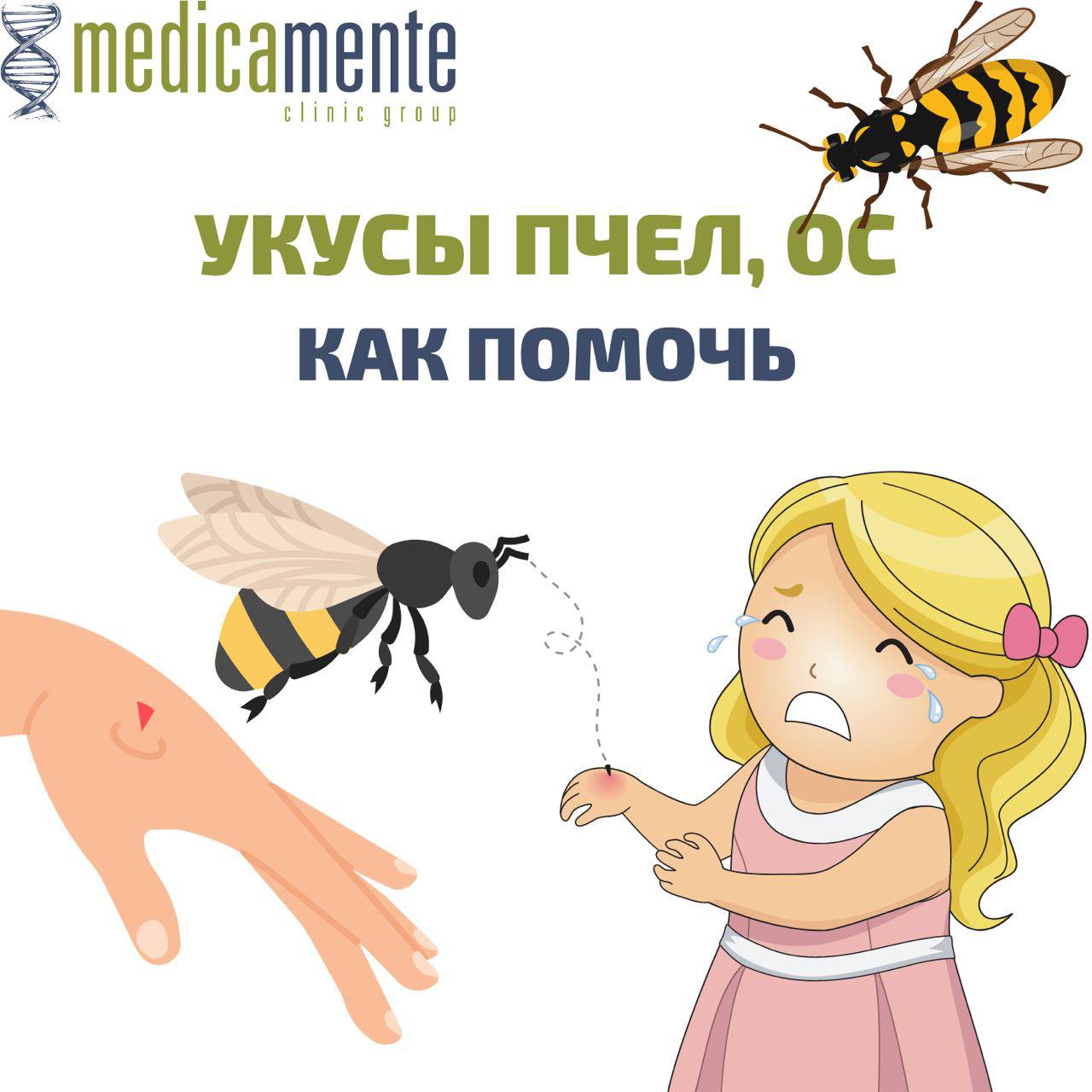 Как помочь при укусе пчёл и/или ос